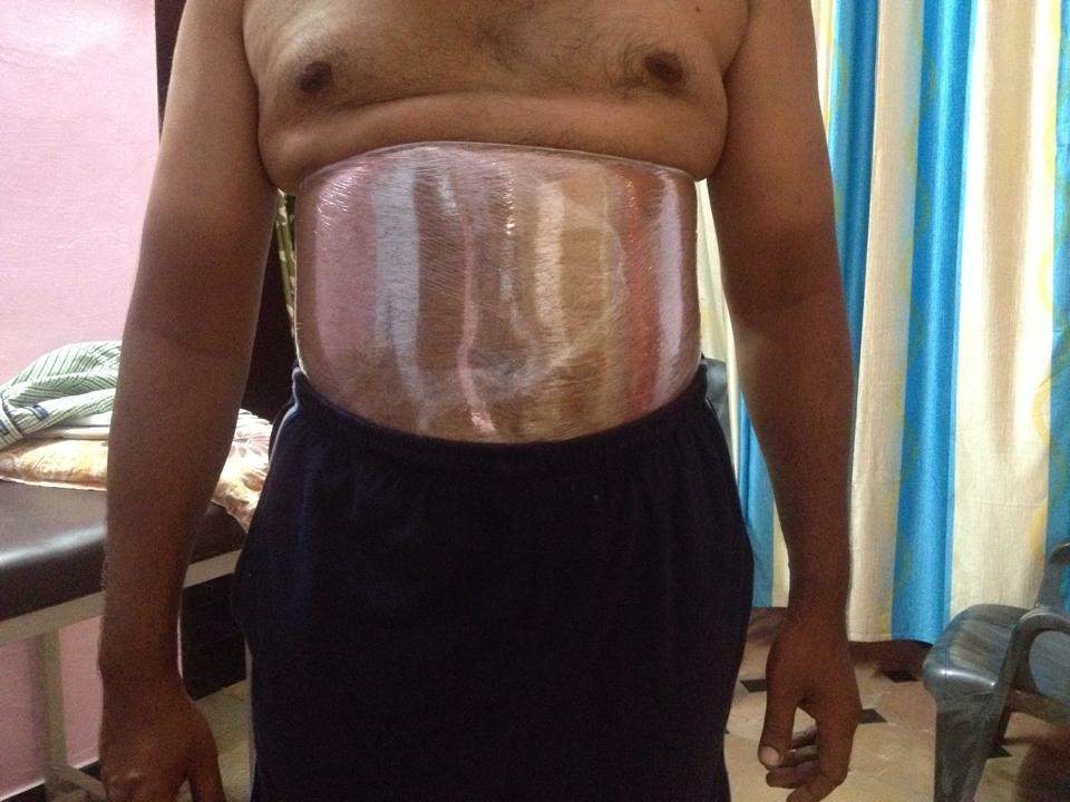 Dondapatis Weight Loss  Slimming Clinic