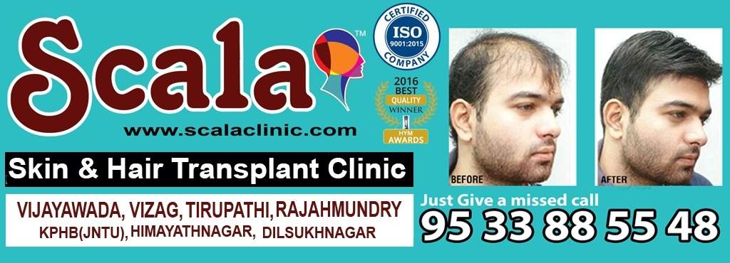 Scala Skin and Hair Transplant
