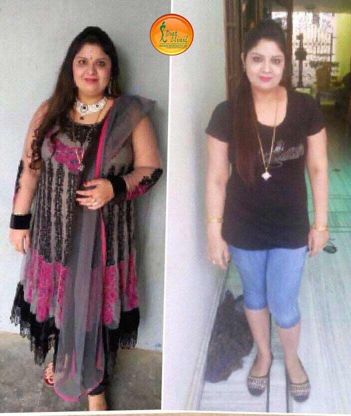 Sundeep Weight Loss Center